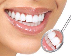 Hollywood smile