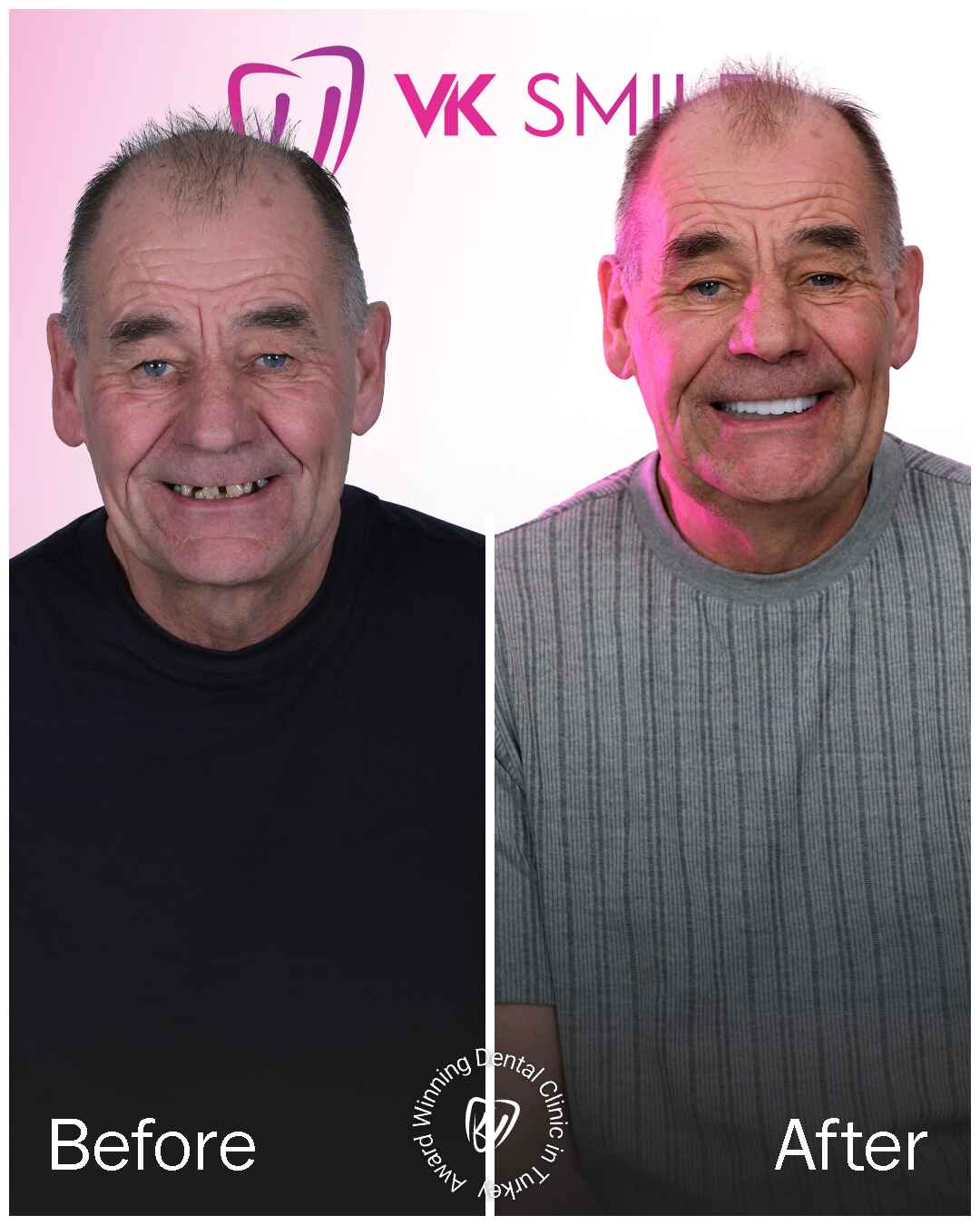 Before After VK Smile Studio (16)