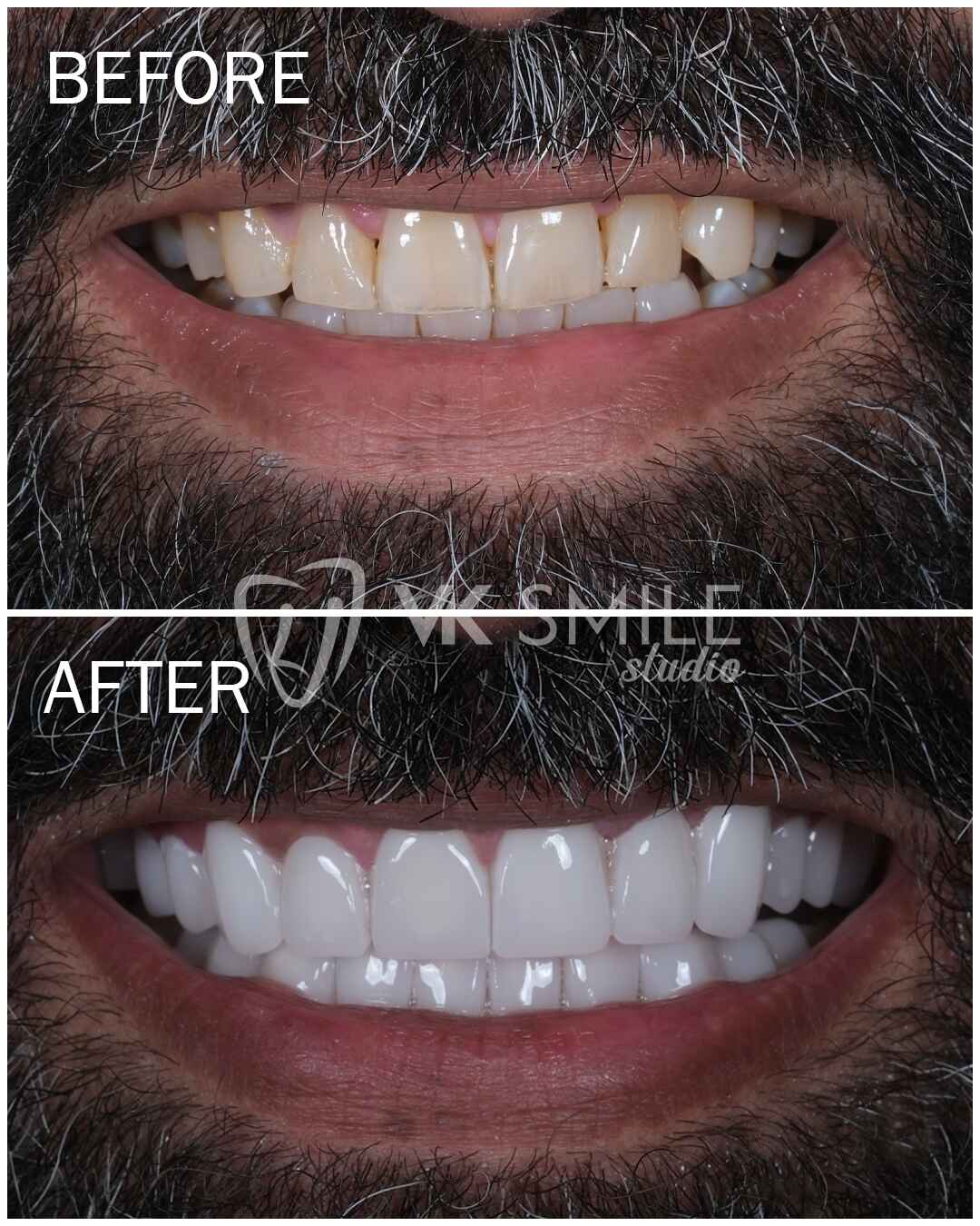 Before After VK Smile Studio (17)