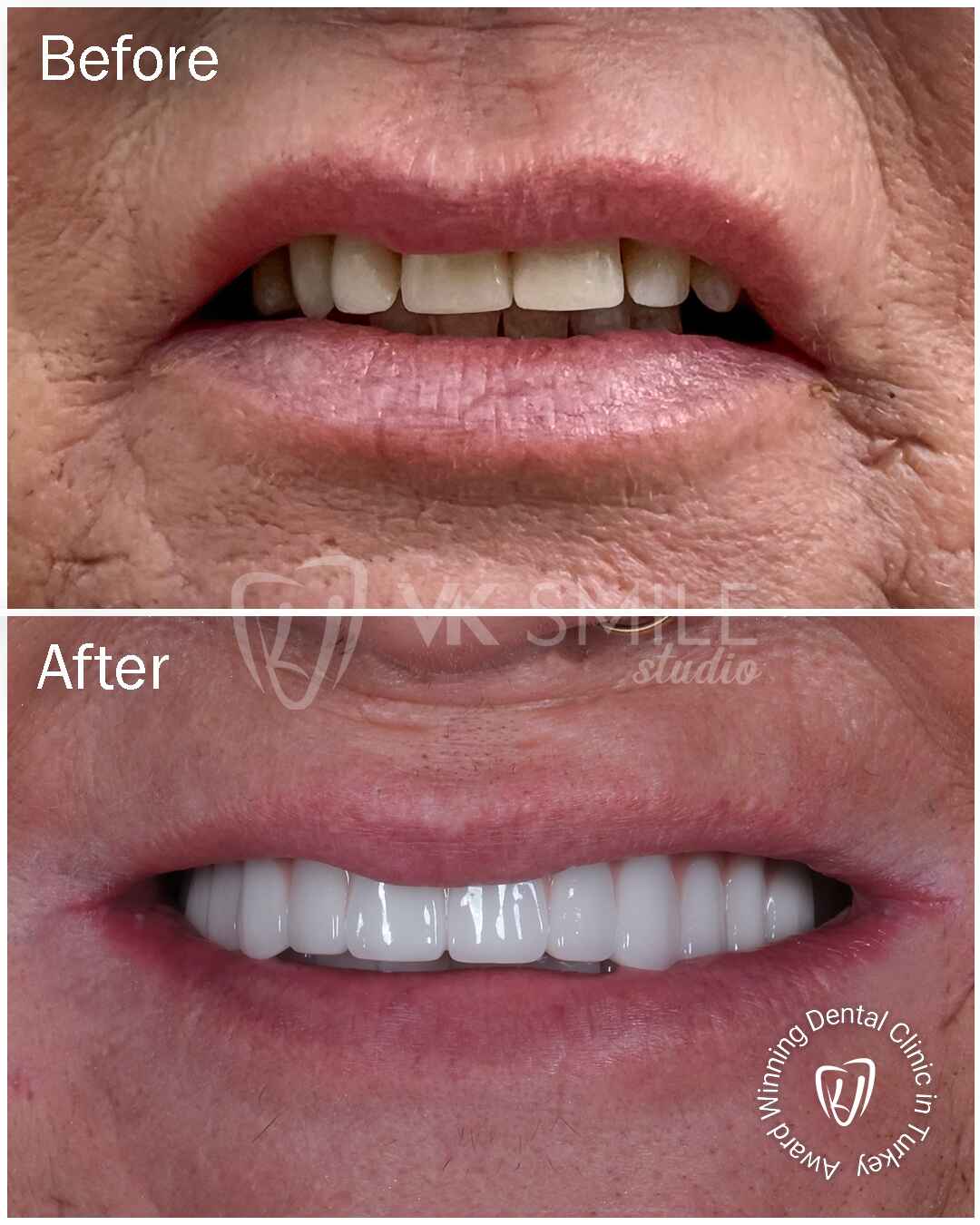 Before After VK Smile Studio (19)