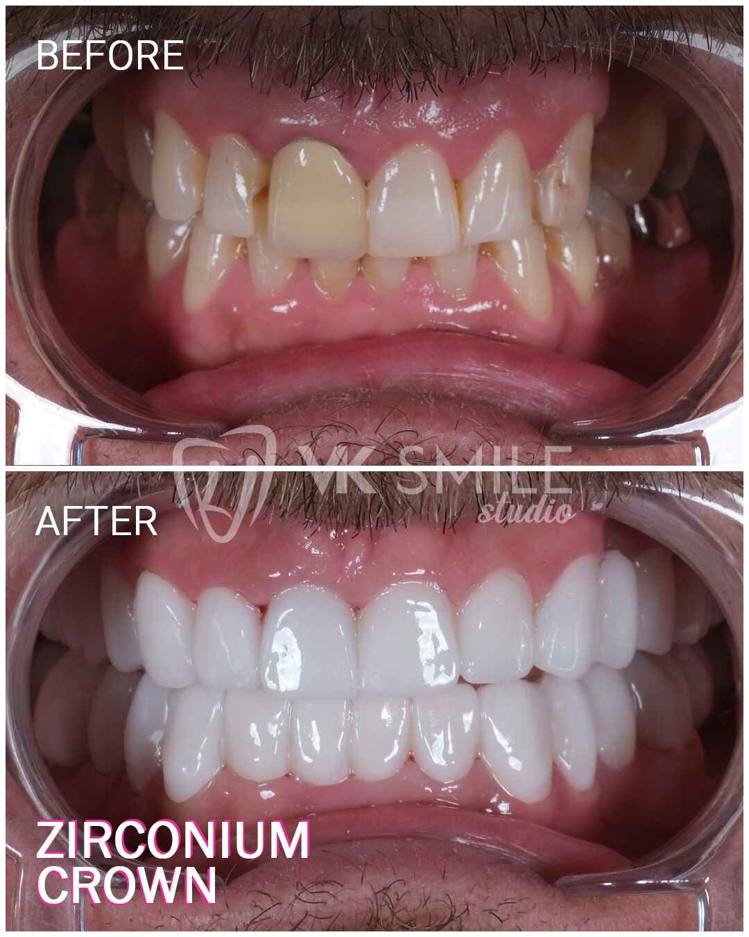 Before After VK Smile Studio (9)
