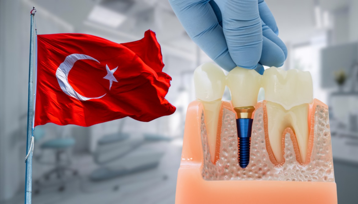 Dental Implants Turkey
