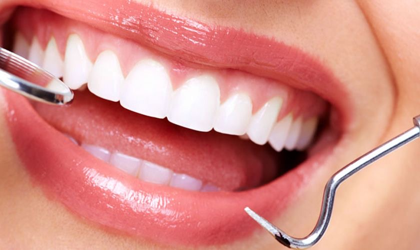 Porcelain Veneers in Turkey