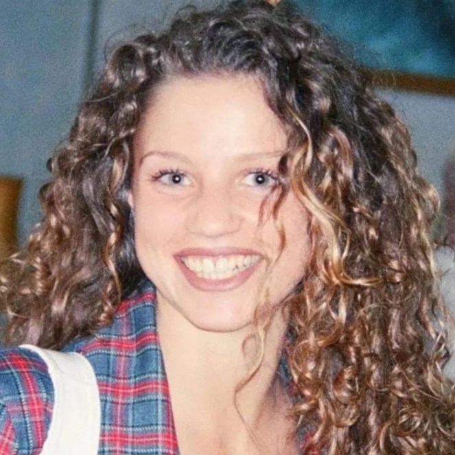 Katie Price teeth before