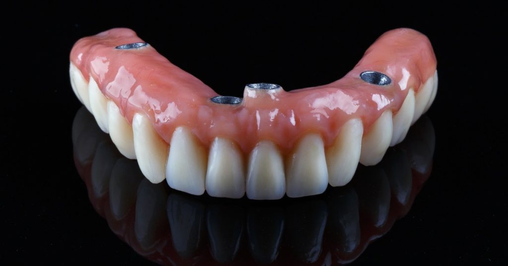 VK Smile Studio All-on-4 main