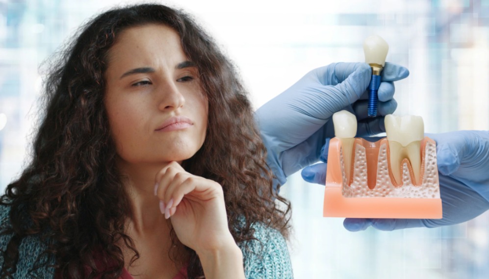 When Is a Dental Implant Needed