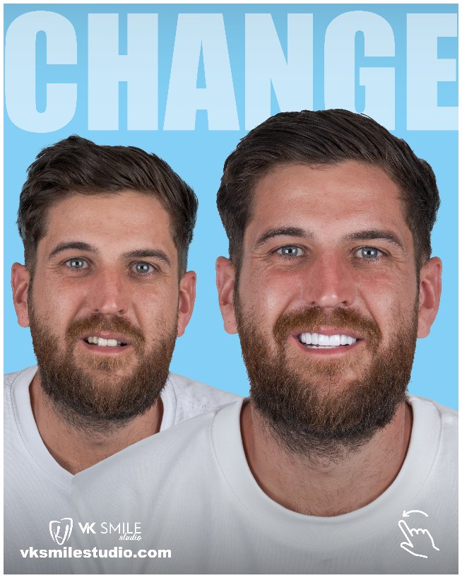 before after 14