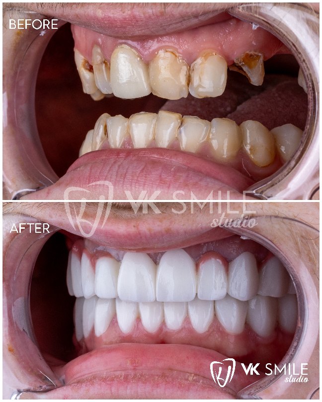 VK Smile Studio before after