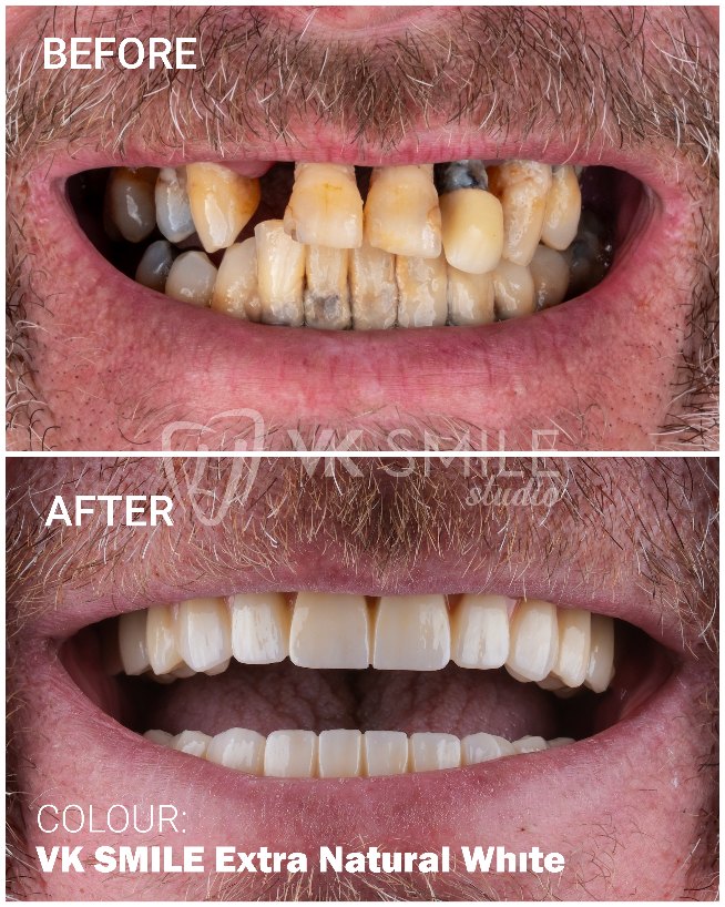 VK Smile Studio before after