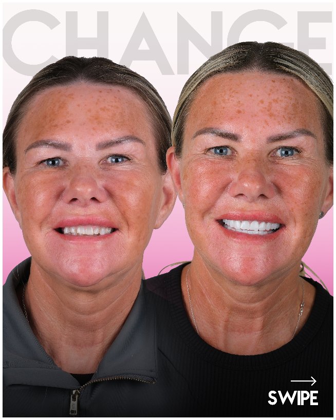 Before after teeth Turkey
