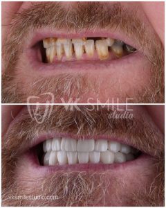 VK Smile Studio before after