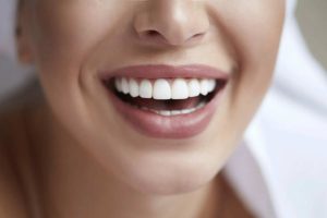 Dental Veneers in Istanbul, Turkey