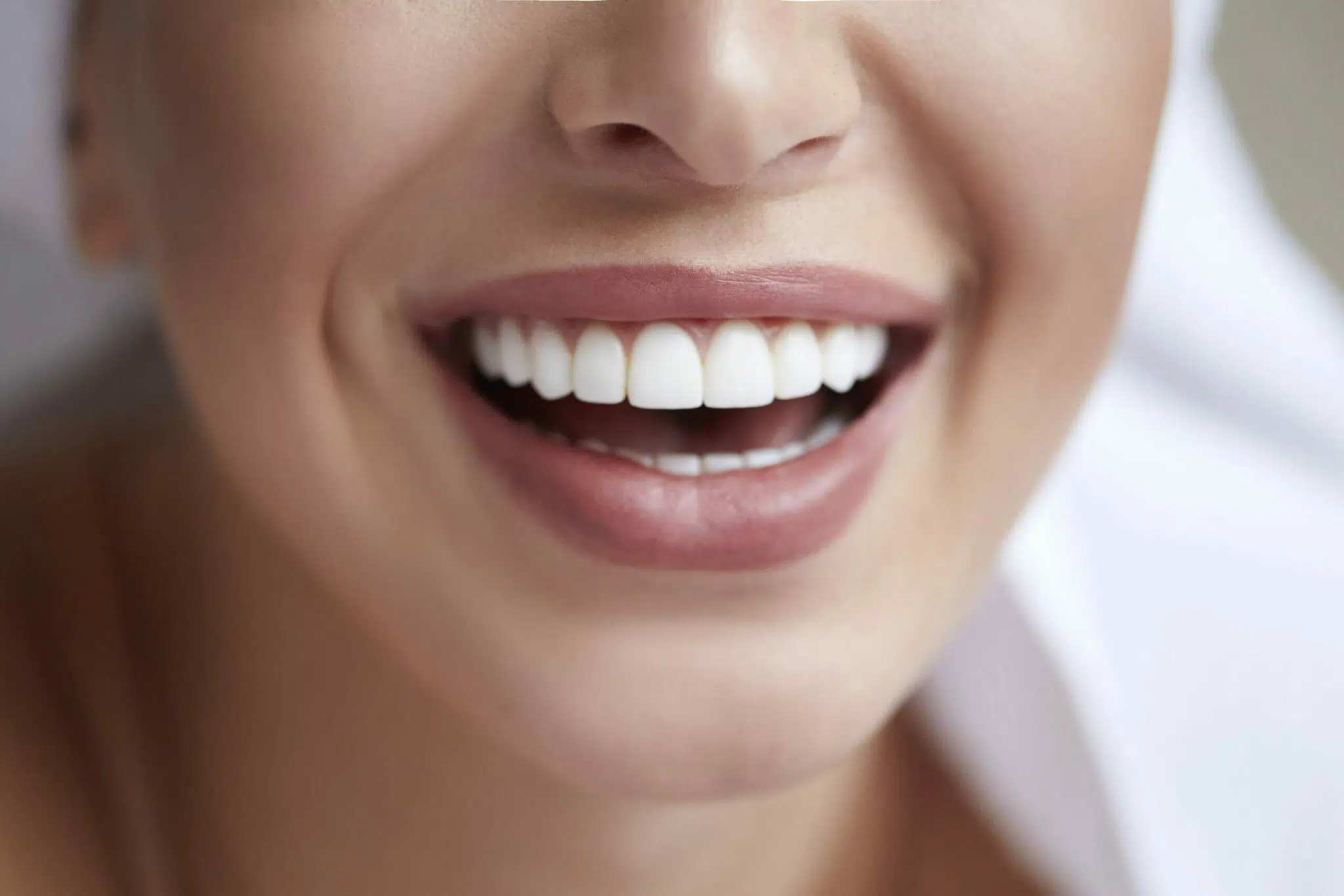 Dental Veneers in Istanbul, Turkey