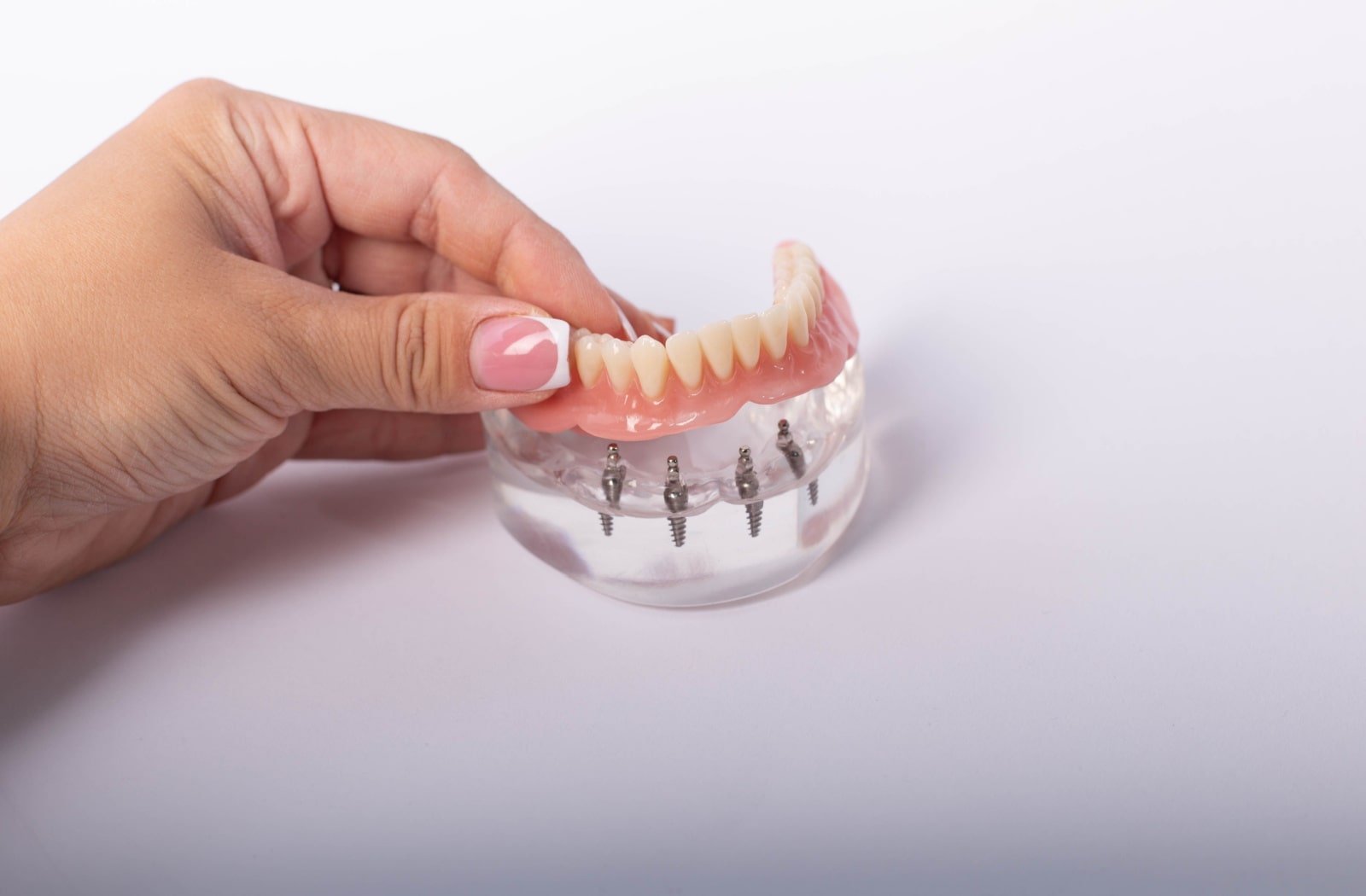 Full Set of Teeth Implants in Turkey