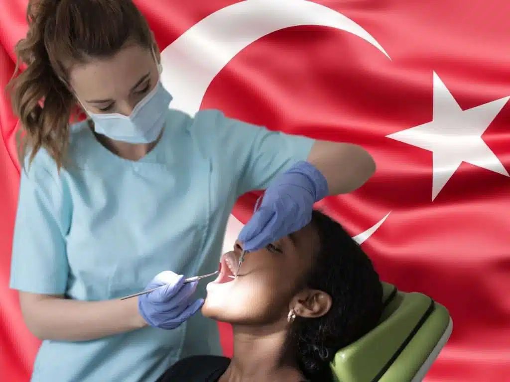 Guide for Turkey Teeth