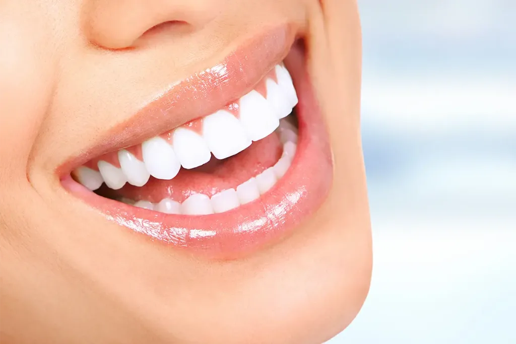 Hollywood smile in Turkey