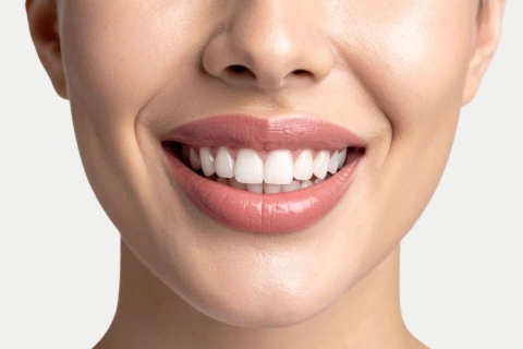 Hollywood Smile