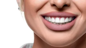 Cosmetic smile makeover in Turkey