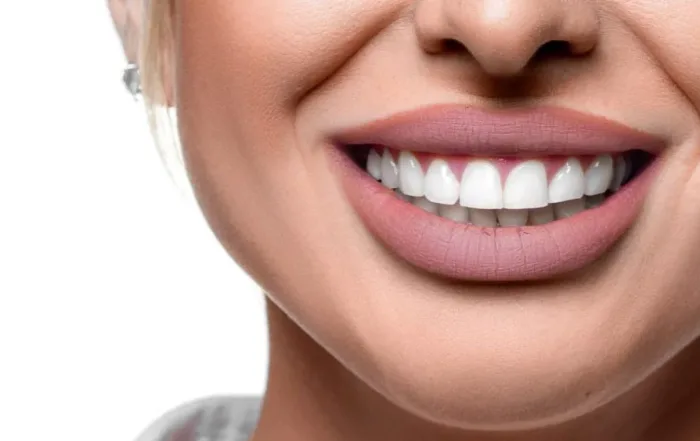 Cosmetic smile makeover in Turkey