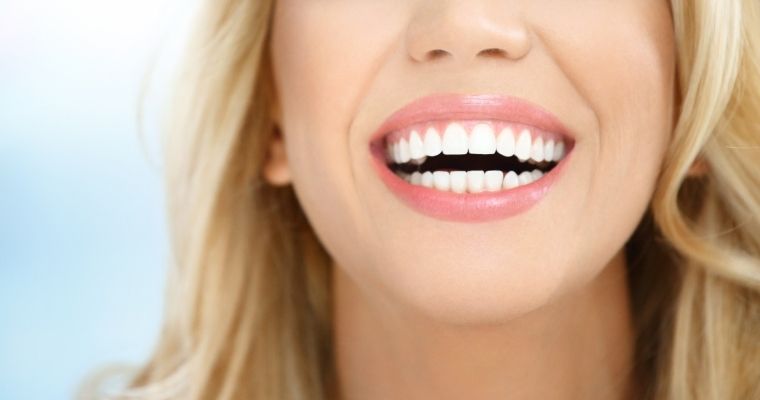 Smile Makeover in Turkey
