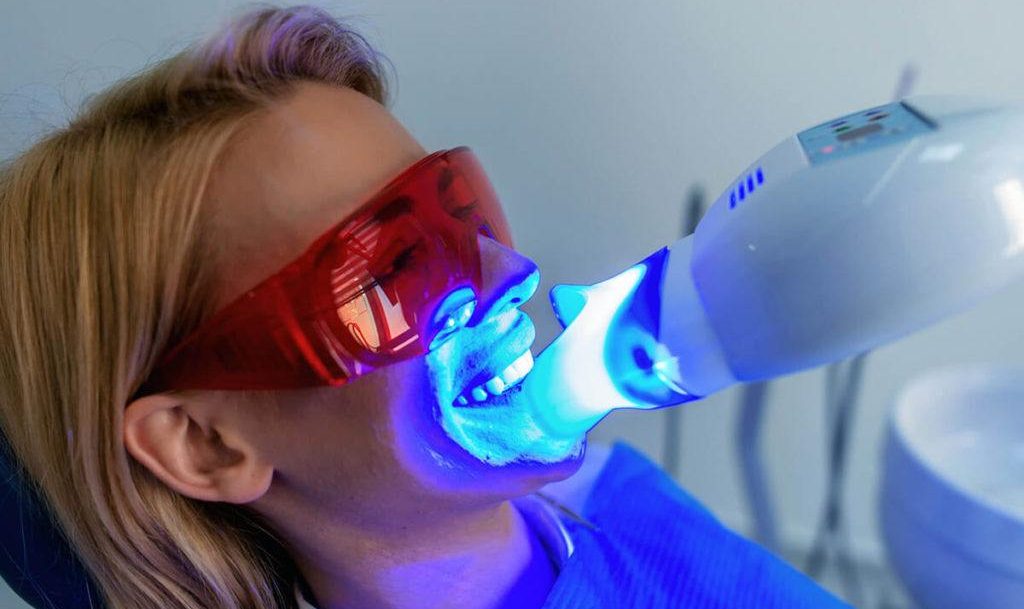 Teeth Whitening in Turkey