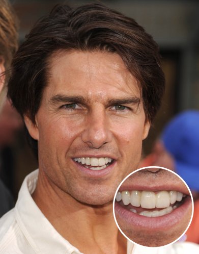 tom cruise teeth