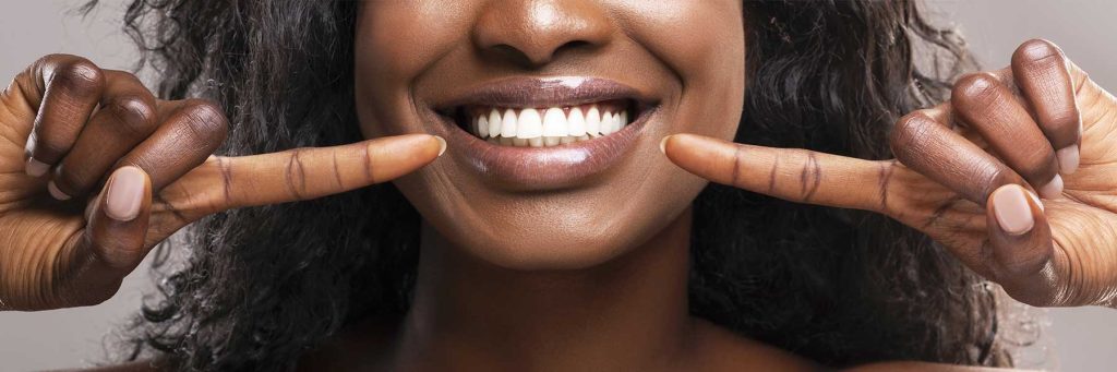 What Is Turkey Teeth Trend?