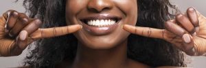 What Is Turkey Teeth Trend?