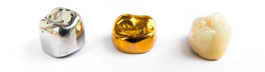 Porcelain Metal Crown Types