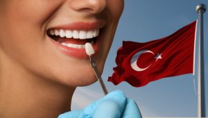 Are Veneers in Turkey Worth It: Cost Benefits Explained