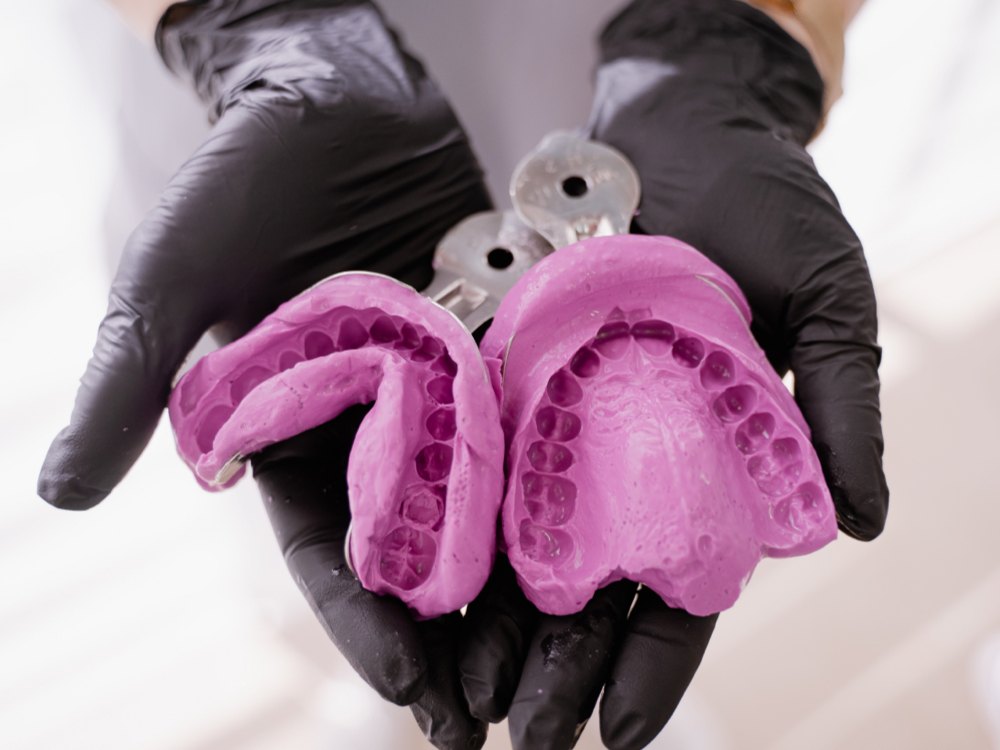 Dentition Impressions