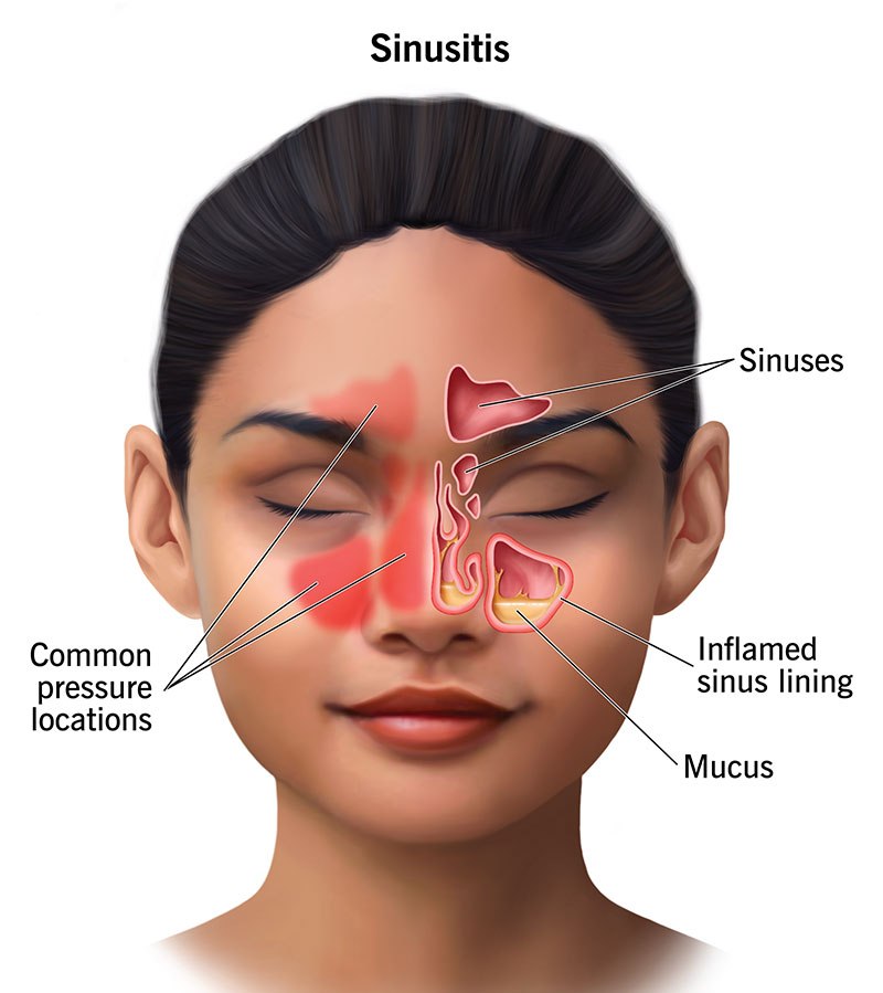 What Is the Sinus