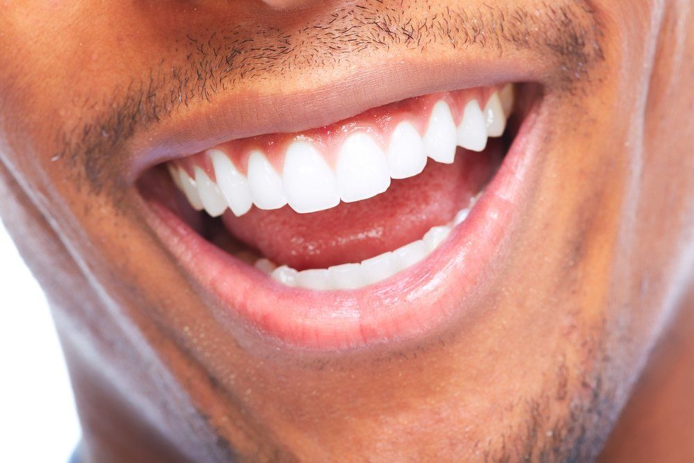 Where Is Best to Get Your Teeth Done in Turkey?