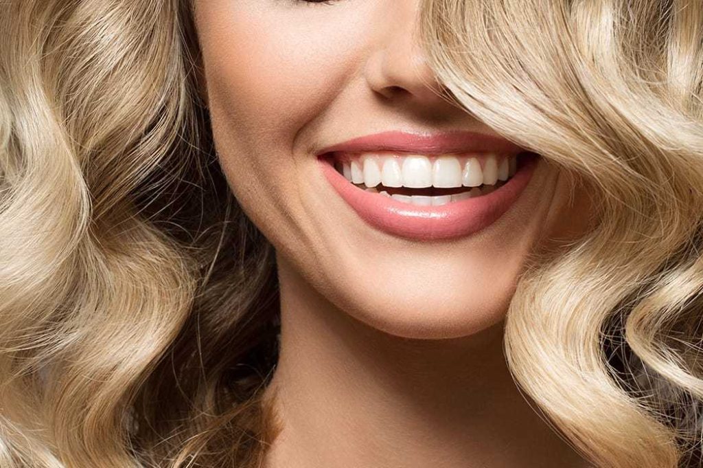 Dental Veneers in Istanbul, Turkey
